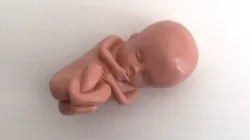 Embryo-Modell / Aktion Lebensrecht für Alle