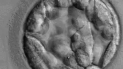 Ein fünf Tage alter menschlicher Embryo / RWJMS IVF Program via Wikimedia (Gemeinfrei)