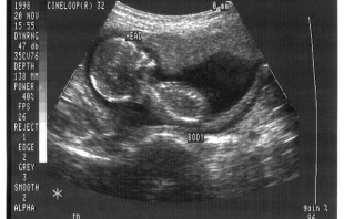Ultraschall / CDC/Jim Gathany